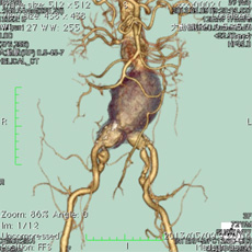 cardiovascular_img08.jpg