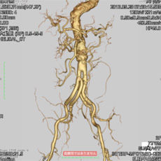 cardiovascular_img09.jpg